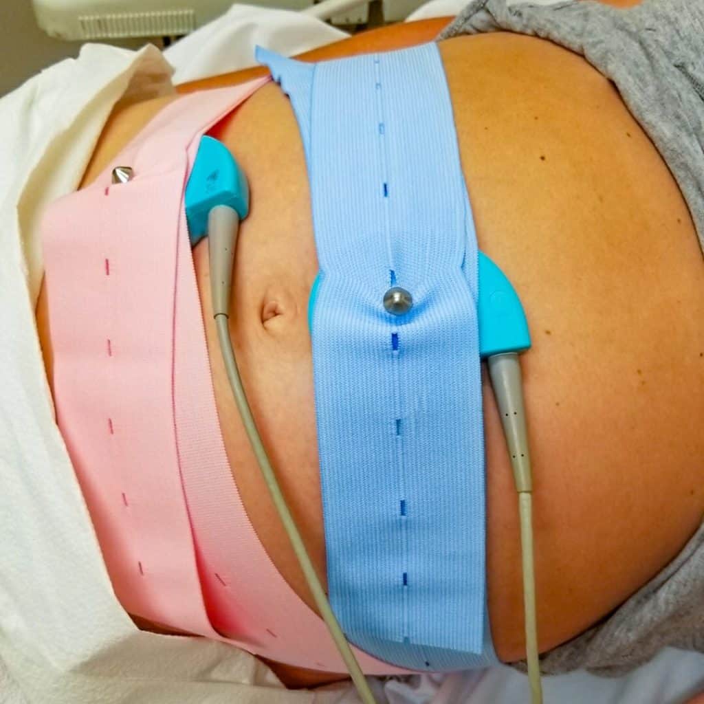 Picture of belly monitoring for pregnant women. 